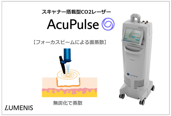 スキャナー搭載型CO2レーザー(AcuPulse)