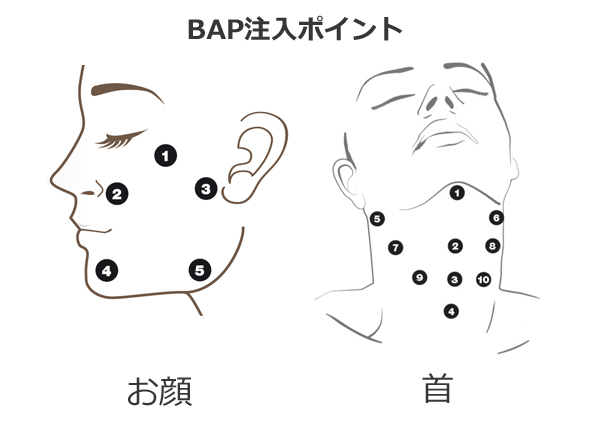 BAP注入ポイント
