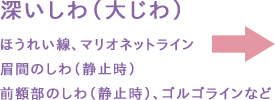 大じわ
