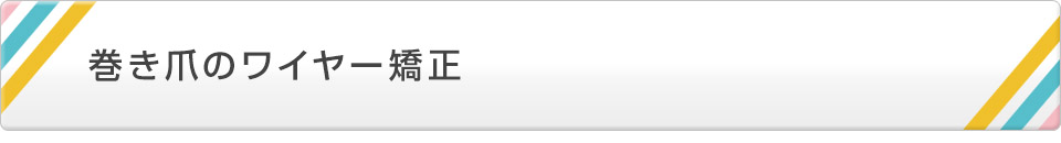 巻き爪のワイヤー矯正
